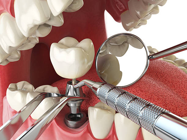 Best Emergency Gum Treatment in Anamosa, IA